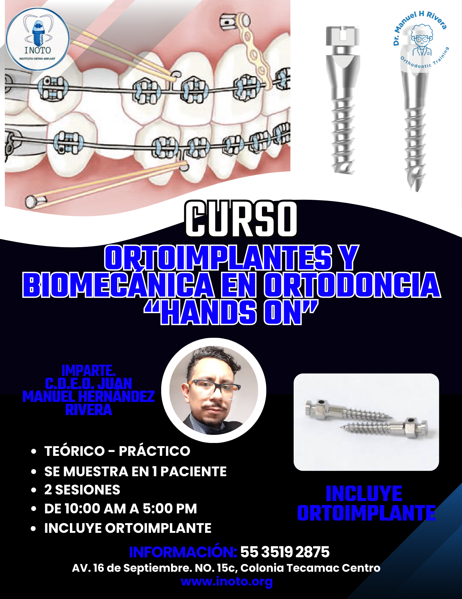 Curso Orthoimplantes y Biomecánica en Ortodoncia